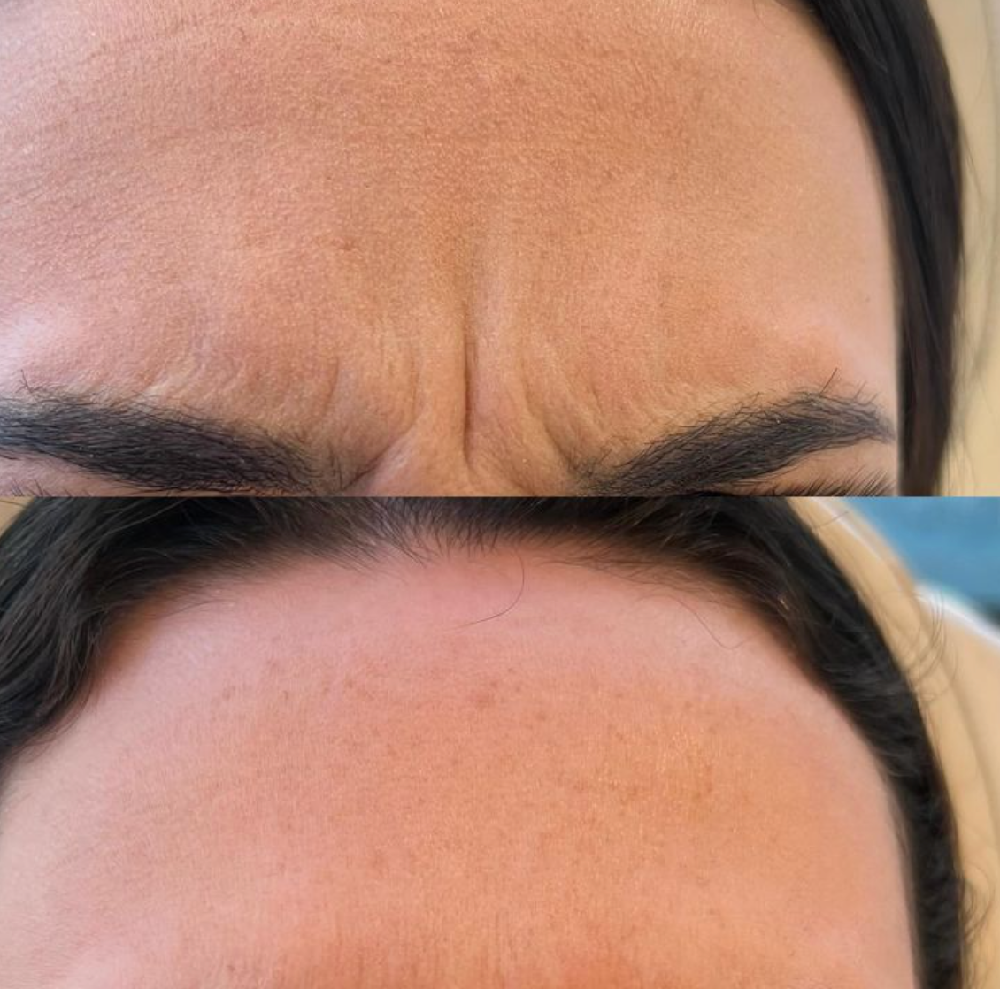 NovaCare Facial and Neck Massager